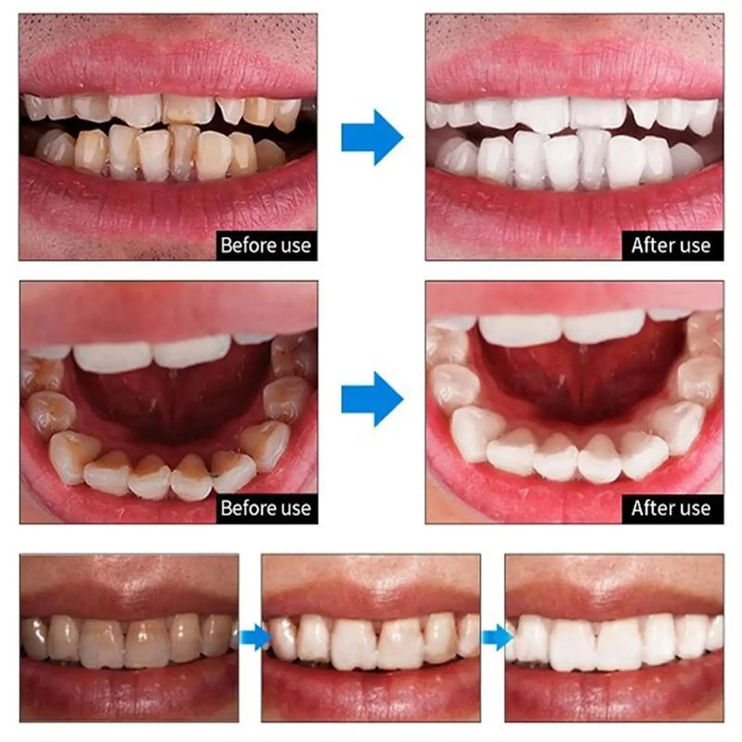 4 Days Teeth Whitening Powder